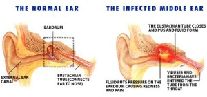 normal-ear-infected-ear